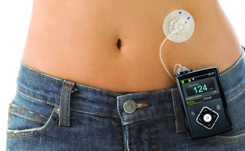 Pompe à insuline Medtronic. C'est le modèle utilisé par mon fils. (photo Medtronic)